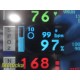 Spacelabs 91370 Ultraview SL Patient Monitor W/ Modules, NEW Leads & PSU ~ 35465