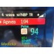 Philips Intellivue X2 M3002A Ref 865039 Transport Monitor W/O Battery ~ 35481