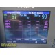 2011 Philips Intellivue MMS X2 M3002A Companion Monitor W/O Leads ~ 35482