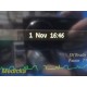 2011 Philips Intellivue X2 M3002A Ref 865039 MMS MODULE/MONITOR W/ BATTERY~35490