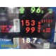 Spacelabs 91370 Ultraview SL Patient Monitor W/ Module, Leads & Adapter ~ 35829