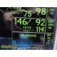 GE Dash 5000 Patient Monitor (2X IPB, NBP, ECG, SpO2, TEMP) W/ NEW Leads ~ 35915