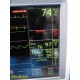 GE Dash 5000 Patient Monitor (2X IPB, NBP, ECG, SpO2, TEMP) W/ NEW Leads ~ 35915
