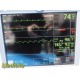 GE Dash 5000 Patient Monitor (2X IPB, NBP, ECG, SpO2, TEMP) W/ NEW Leads ~ 35915