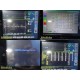 Spacelabs 91387 Ultraview CPU W/ Xprezzon Monitor, CO2/Comm Modules, Leads~35963