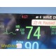 Philips Intellivue MP30 Patient Monitor W/ M3001A, M3012A Modules & Leads ~35932