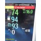 Philips Intellivue MP30 Patient Monitor W/ M3001A, M3012A Modules & Leads ~35932