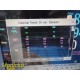 Philips Intellivue MP30 Patient Monitor W/ M3001A, M3012A Modules & Leads ~35932