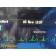 Philips MP70 (M8007A) Critical Care Monitor W/ MMS, PRINT Module & Leads ~ 35934