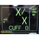GE Dash 5000 Patient Monitor W/O Leads (IBP, SPO2, Temp, ECG, NBP, CO2) ~ 35928