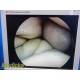 Smith & Nephew DYONICS 3626 4mmx30° Video Rigid Telescope | Arthroscope ~ 36798