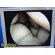 Smith & Nephew DYONICS 3626 4mmx30° Video Rigid Telescope | Arthroscope ~ 36798