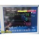 Philips MP70 (M8007A) Neonatal Monitor W/ MMS, PRINT Module & Leads ~ 35986