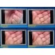 2016 Karl Storz EJ-MLA26UK1 Full HD 26" Surgical LED Display W/ Adapter ~ 36526