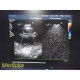 Philips S7-2 Omni Transesophageal Phased Array Ultrasound Probe W/ Case ~ 36536