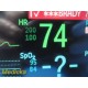 2012 Philips Intellivue MP30 Neonatal Monitor W/ NEW Leads & MMS Module ~ 36511