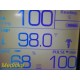 Welch Allyn 45NTO Spot Vital Signs LXI Monitor W/ PSU & NEW Patient Leads ~36589