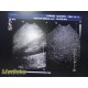 Philips IU-22 S4-1 Phased Array Ultrasound Probe 4000-0966-02 (TESTED) ~ 36675