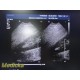 Philips IU-22 S4-1 Phased Array Ultrasound Probe 4000-0966-02 (TESTED) ~ 36675