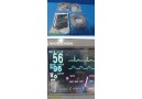 Nihon Kohden Life Scope N Bedside Patient Monitor (OPV-1500K) LEADS SET ~ 37024