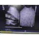Philips IU-22 S4-1 Sector Array Ultrasound Probe 4000-0966-02 (TESTED) ~ 36161