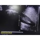 Philips IU-22 S4-1 Sector Array Ultrasound Probe 4000-0966-02 (TESTED) ~ 36161