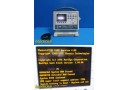 BioZ CardioDynamics BZ-4000-101 ICG Monitor Only (For Parts) ~ 36710