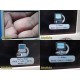 Smith&Nephew 72200559 560P HD Camera Control Unit W/ Camera Head & Coupler~36764