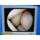 Smith & Nephew DYONICS 7205922 4mmx30° HD Arthroscope W/ ED-3 Camera Head ~36236