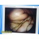 Smith & Nephew DYONICS ED-3 Camera Head W/ 7205922 Video Arthroscope ~ 36757