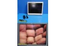Stryker 21" Vision Elect Flat Panel Monitor Ref 240-030-930 W/ Adapter ~ 36743