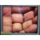 Stryker 21" Vision Elect Flat Panel Monitor Ref 240-030-930 W/ Adapter ~ 36743