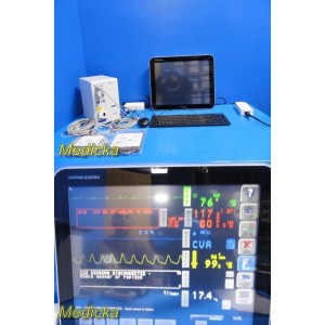 https://www.themedicka.com/22169-270423-thickbox/spacelabs-91387-ultraview-cpu-w-xprezzon-monitor-co2-comm-modules-leads36232.jpg