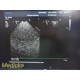 Philips S7-3T Pediatric / Adult Transesophageal Ultrasound Probe W/ Case ~36259