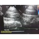 Philips S7-3T Pediatric / Adult Transesophageal Ultrasound Probe W/ Case ~36259