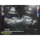 Philips S7-3T Pediatric Transesophageal Ultrasound Probe W/ Carrying Case ~36789