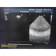 Philips S5-1 P/N 21314A Sector Array Ultrasound Probe Ref 453561176747 ~ 36784