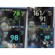 GE Dash 4000 Patient Monitor (2X IPB, NBP, ECG, SpO2, TEMP) W/ NEW Leads ~ 36802