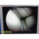 Smith & Nephew Ref 3628 DYONICS 4mmx70° Video Arthroscope Rigid Telescope ~36281