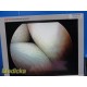 Smith & Nephew 3628 DYONICS 4mmx70° Video Rigid Telescope | Arthroscope ~ 36282