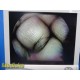 Smith & Nephew 3628 DYONICS 4mmx70° Video Rigid Telescope | Arthroscope ~ 36282