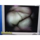 Smith & Nephew 3628 DYONICS 4mmx70° Video Rigid Telescope | Arthroscope ~ 36282