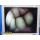 Smith & Nephew 3628 DYONICS 4mmx70° Video Rigid Telescope | Arthroscope ~ 36282