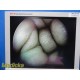 Smith & Nephew 3628 DYONICS 4mmx70° Video Rigid Telescope | Arthroscope ~ 36282