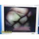 Smith & Nephew 3628 DYONICS 4mmx70° Video Rigid Telescope | Arthroscope ~ 36282