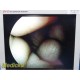 Smith & Nephew DYONICS 3628 4mmx70° Video Rigid Telescope | Arthroscope ~ 36805