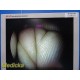 Smith & Nephew DYONICS 3628 4mmx70° Video Rigid Telescope | Arthroscope ~ 36805