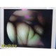Smith & Nephew DYONICS 3628 4mmx70° Video Rigid Telescope | Arthroscope ~ 36805