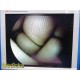 Smith & Nephew DYONICS 3628 4mmx70° Video Rigid Telescope | Arthroscope ~ 36805