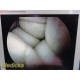 Smith & Nephew 3628 DYONICS 4mm 70° Arthroscopy – Rigid Video Scope ~ 36808
